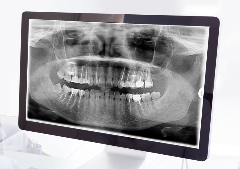 digital xrays