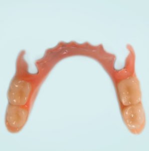 Flexible denture oakville