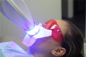 zoom whitening oakville