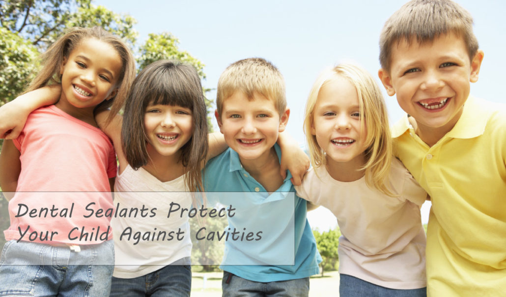 dental sealants