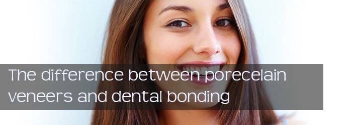 veneer bonding