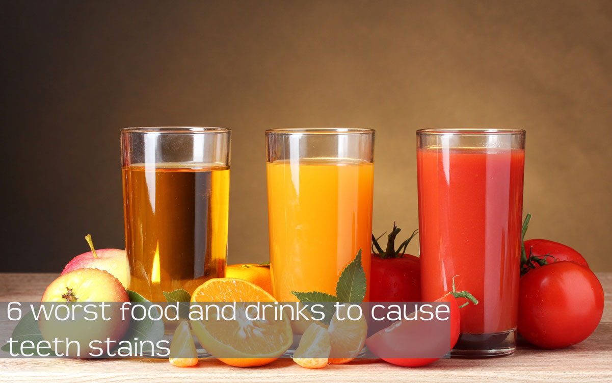 food drinks teeth stains