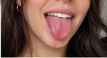 The tongue and oral health