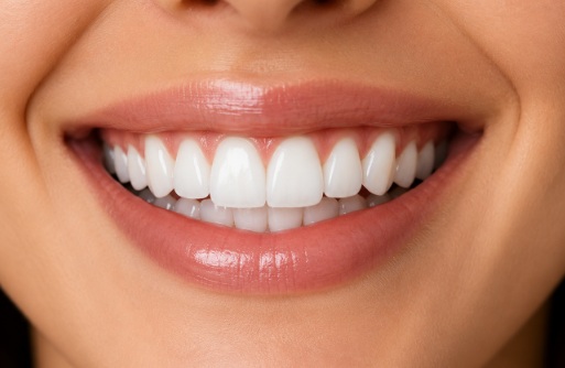 Natural-looking smile showing how tooth shape, spacing, and old dental work can affect appearance